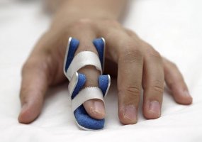 Fratura dos Dedos (Falanges)